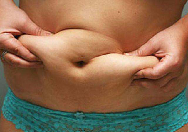 how to avoid a tummy tuck 5e2b281f0e019